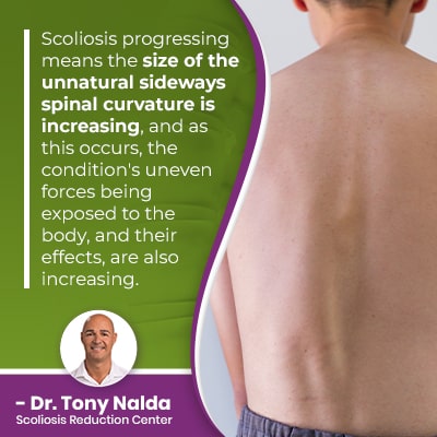 Scoliosis progressing means the size