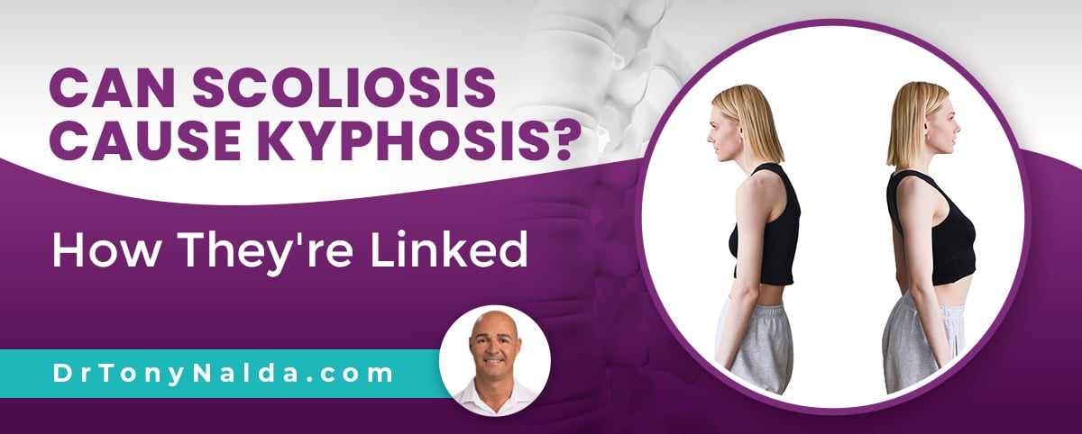 can scoliosis cause kyphosis