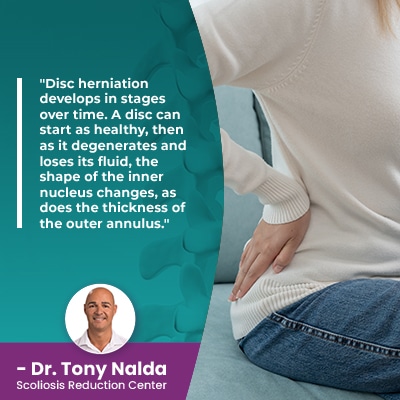 disc herniation develops in