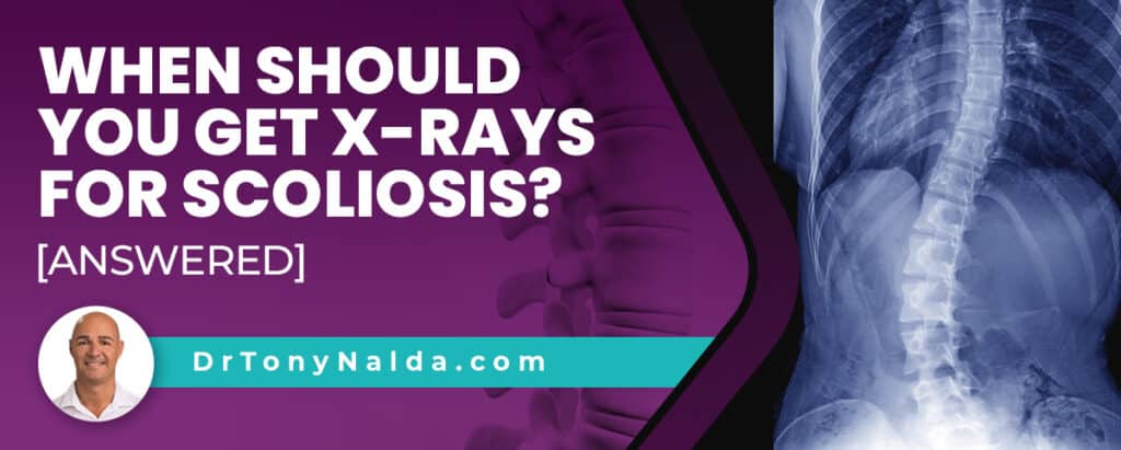 When Should You Get X-rays For Scoliosis? [ANSWERED]