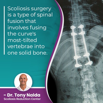 scoliosis surgery is a type