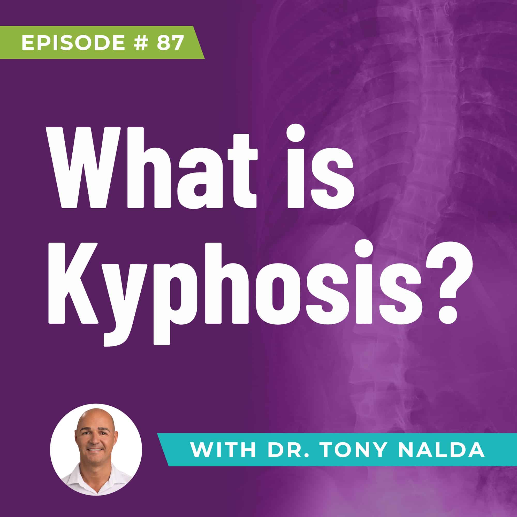 What is Kyphosis?