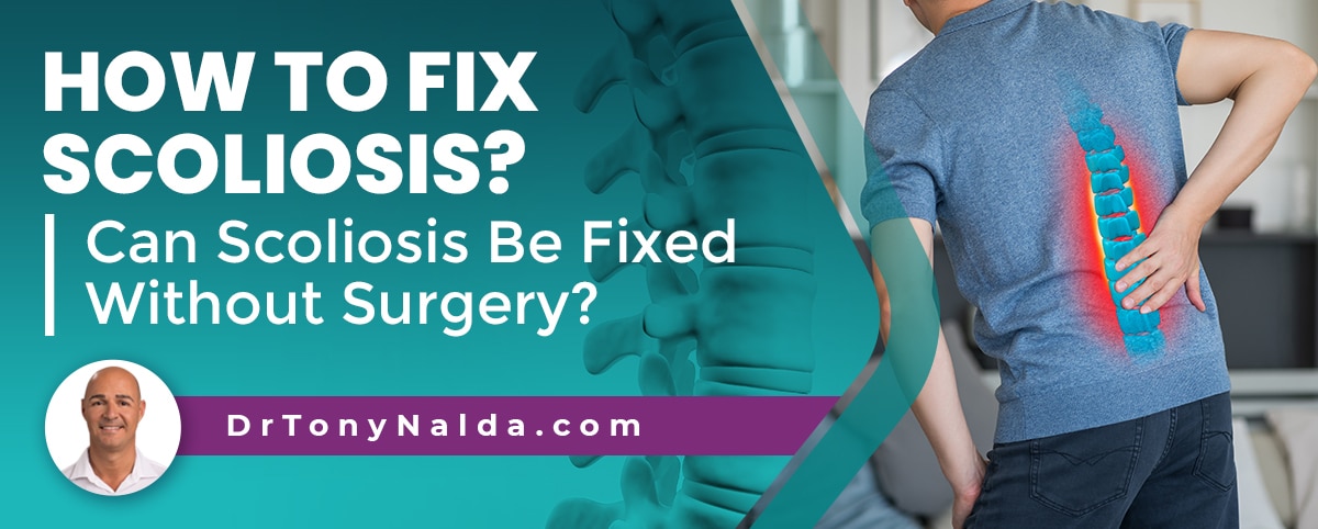 how to fix scoliosis can scoliosis be fixed without surgery