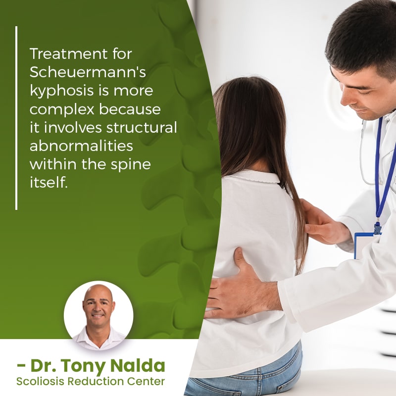 treatment for scheuermanns