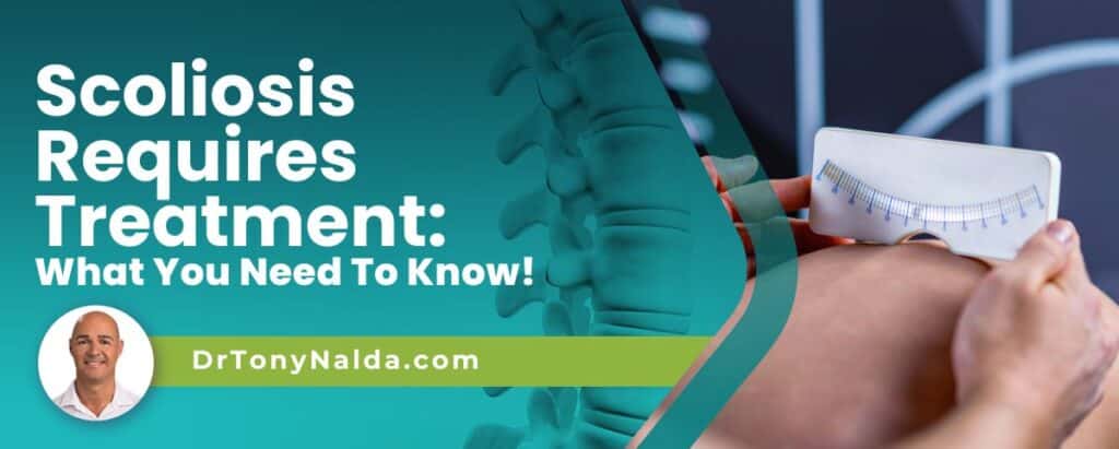 Scoliosis Requires Treatment: What You Need To Know!