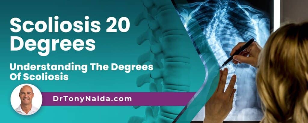Scoliosis 20 Degrees: Understanding The Degrees Of Scoliosis