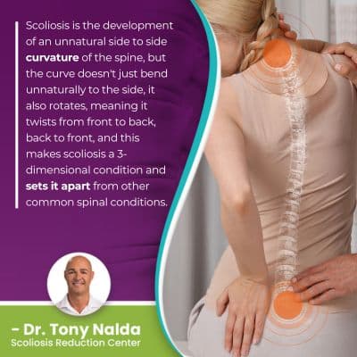 scoliosis-is-the-development-of-400