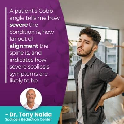 a patient's Cobb angle tells