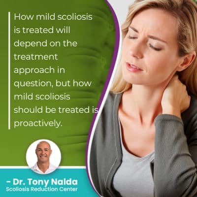 how mild scoliosis is