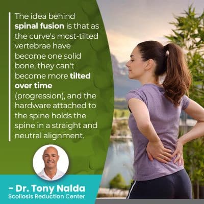 the idea behind spinal fusion