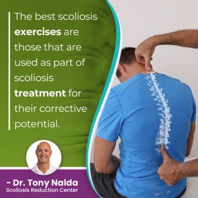 the best scoliosis exercises