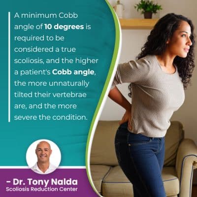 a minimum Cobb Angle