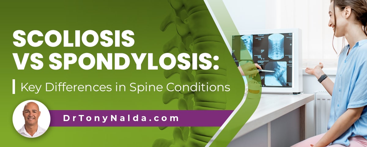 scoliosis vs spondylosis