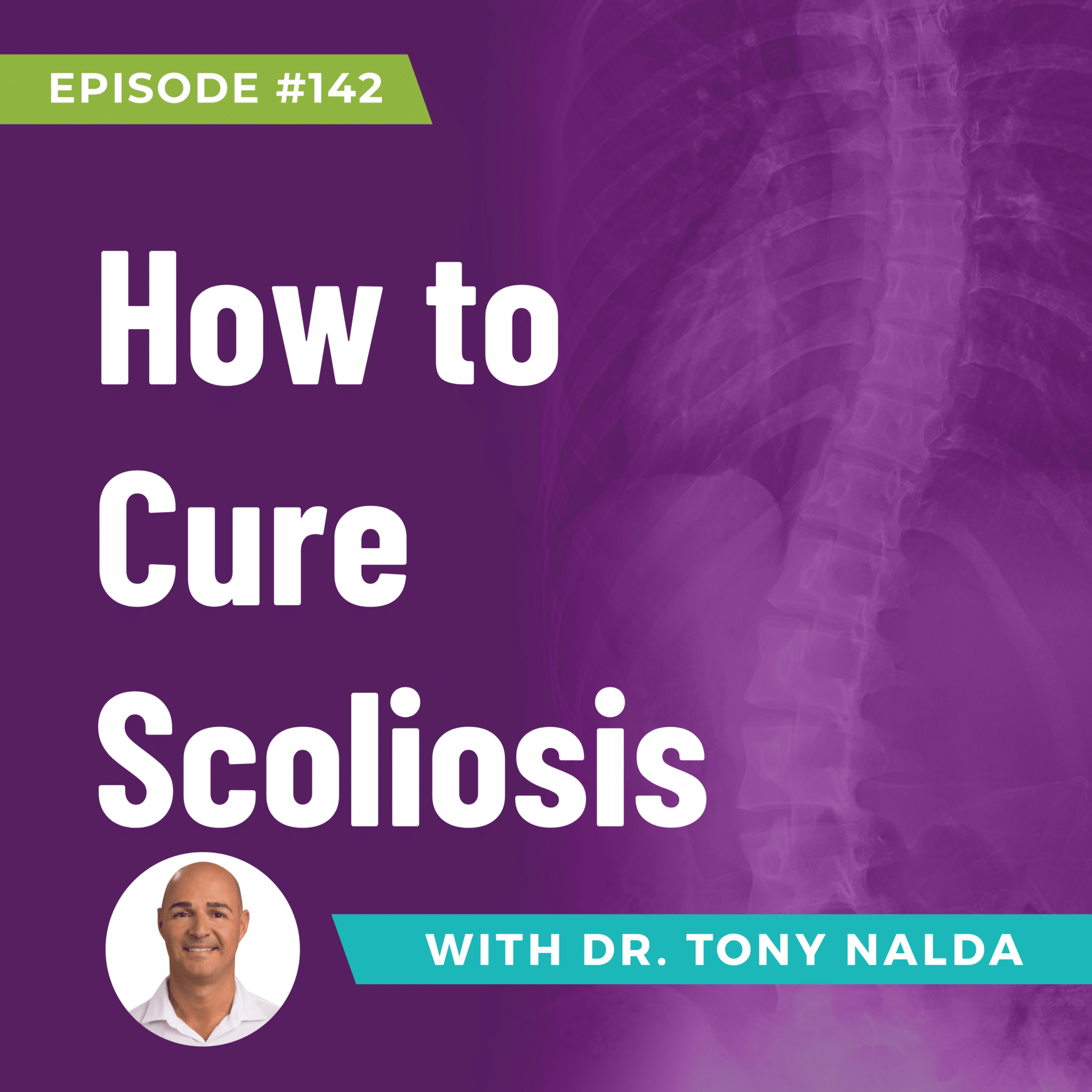 How to Cure Scoliosis