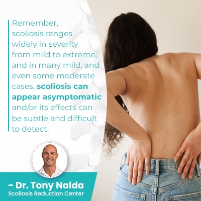 remember scoliosis ranges widely