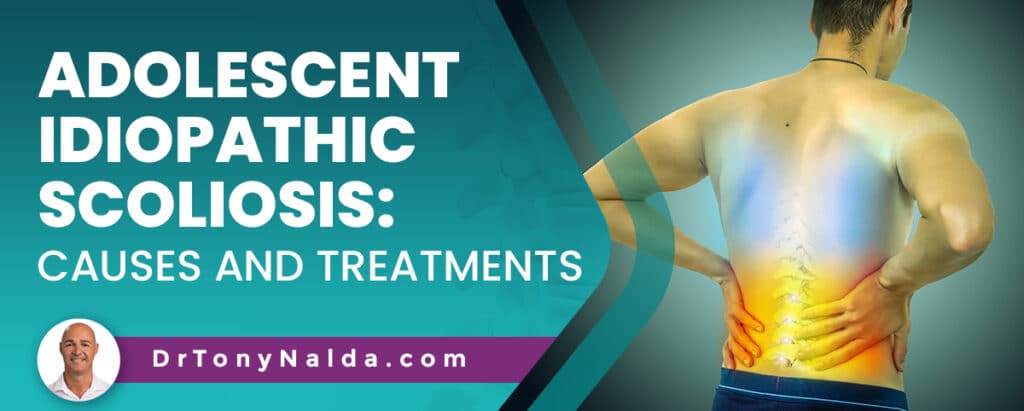 Adolescent Idiopathic Scoliosis: Causes and Treatments