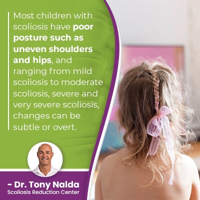 most children with scoliosis