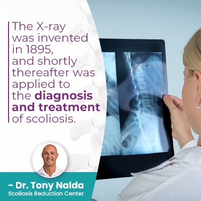 the x ray was invented