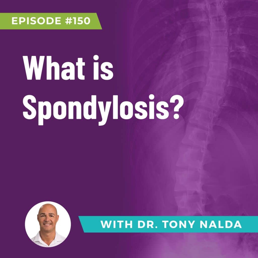 Episode 150: What is Spondylosis?