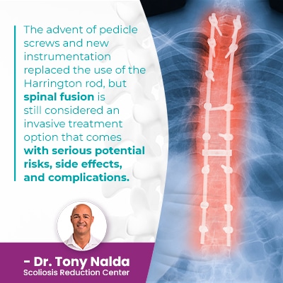 The advent of pedicle screws