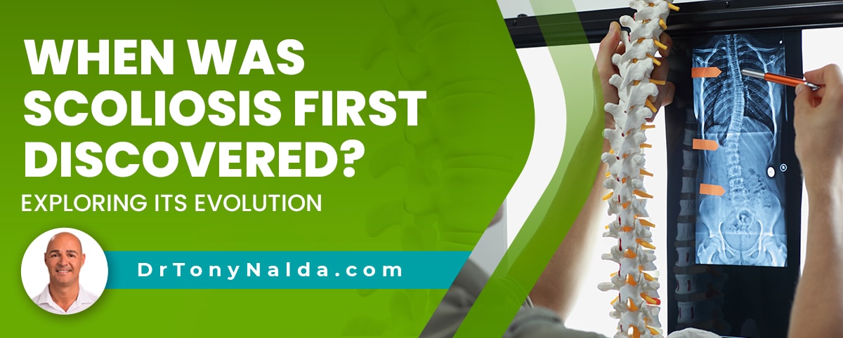 When Was Scoliosis First Discovered Exploring Its Evolution