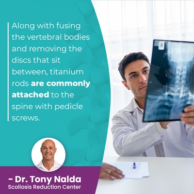 A visual representation of the quote from the text starting with “along with fusing the vertebral"