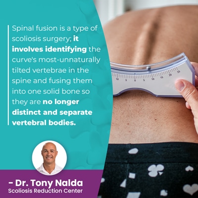 A visual representation of the quote from the text starting with “spinal fusion is a type of scoliosis"
